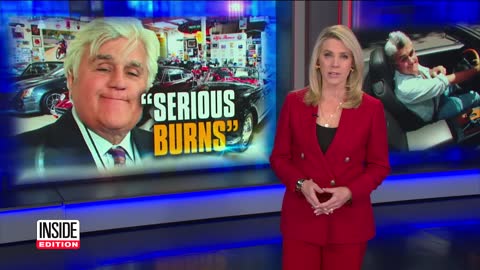 Jay Leno Suffers Serious Burns in Car Fire