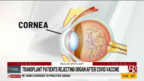 Covid-19 vaccine may causes organ rejection among transplant recipients