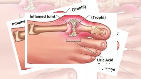 End of Gout Reviews (Shelly Manning Blue Heron Health News)