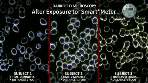 5G SMART METER Radiation DESTROYS Blood Integrity & Oxygenation