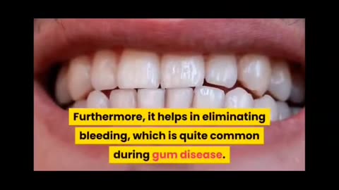 Steel Bite Pro:How to whiten and strong your teeth and gums?