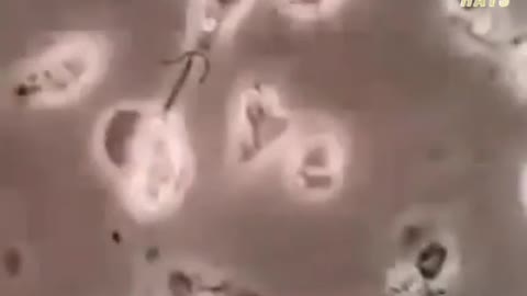 Footage of flouride killing cells