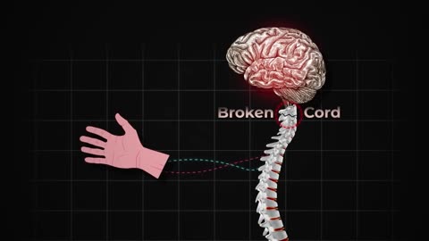 How The Neuralink Brain Chip Actually Works