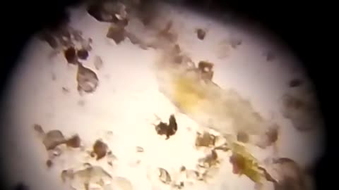 Tardigrado visto al microscopio