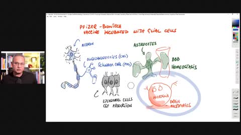 Potentially Reduced Brain Immunity Caused by Pfizer Vaccine (Polish In-vitro Preprint)