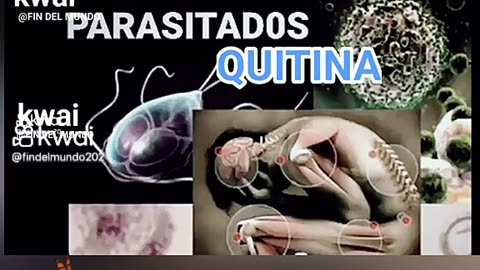 Quitina. Parasitos. Trans humanismo