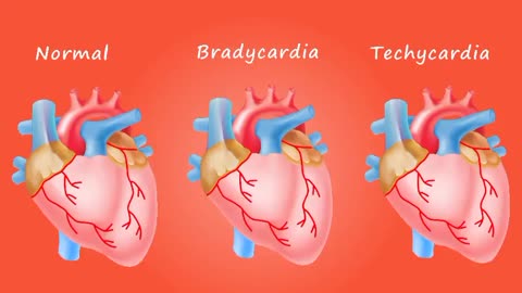 types of heart rates bradycardia tachycardia and normal heart beating