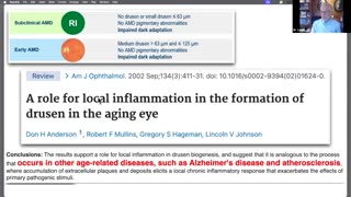 211. EYE DISEASE & EARLY MORTALITY RISK - Q&A