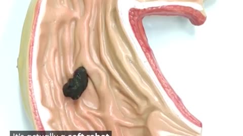 Chinese University of Hong Kong have created a slimy soft robot designed to enter the human body