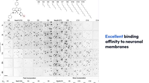 Scientists Discover Key to Unlocking the Secret of Degenerative Brain Disorders Like Alzheimer’s