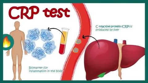 NIACIN B1 find out why!! Heath Matters