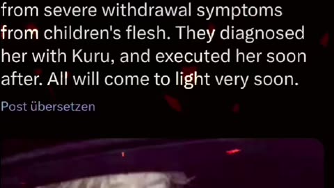 Angela Merkle Arrested In 2019 ~ Was Suffering Severe Shaking From Kuru Disease