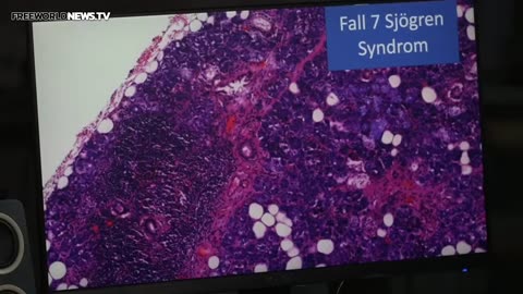 Death shot micro stuctures & nanotechnology