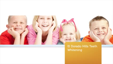 Dr. Michael B. Guess - Teeth Whitening in El Dorado Hills CA