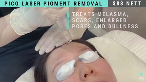 PICO Laser Treatment Singapore 皮秒激光 | $88 - V Medical Aesthetics & Laser Clinic