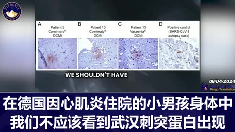 mRNA疫苗會導致心臟病 / mRNA vaccine cause cardio diseases