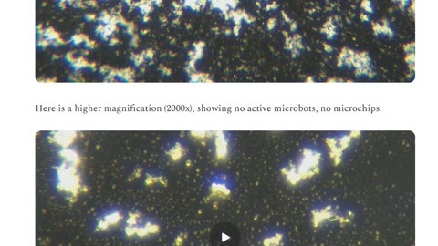 Calcium Disodium EDTA +Vitamin C Deactivates Nano/Microrobots And Dissolves All Microchips In Pfizer