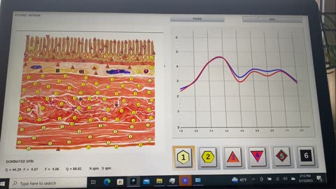 Bioresonance Scans and Therapies