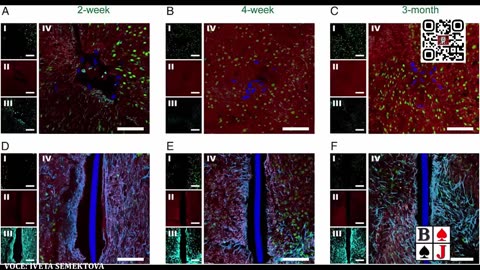 LA RETE NEURALE INIETTABILE