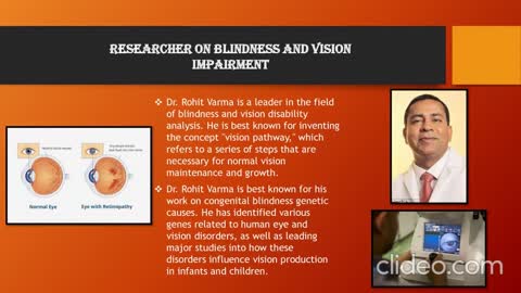 Dr. Rohit Varma - Internationally Recognized Researcher & Ophthalmologist