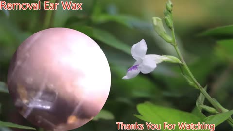 gigantic ear wax removal #12