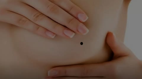 believed that these moles found on the human body can give information about