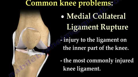 Knee Pain Causes Everything You Need To Know