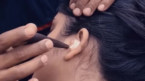 Ear Cleaning with Hydrogen peroxide #asmr #