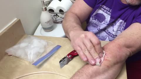 Father Son Bonding Time Cutting of a Cyst