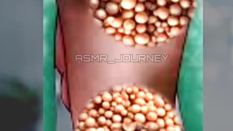 Feet Infection removal animation #removal #asmrtriggers #satisfying