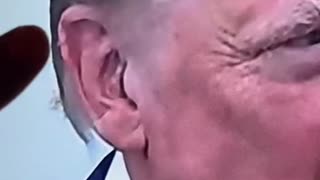 Trump’s Ear