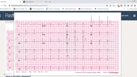 Pastest MRCP II Cardiology 5