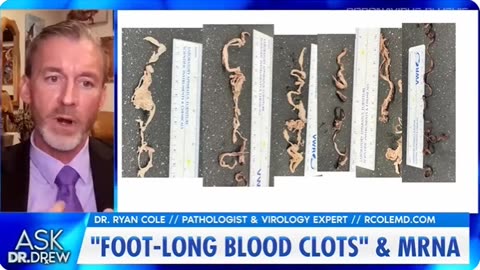 Blood Clots and Covid Shots: Conspiracy Theory vs Scientific Evidence