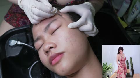 [ASMR] Relax Everyday With Linn Spa Vietnam | Removes acne and brightens facial skin