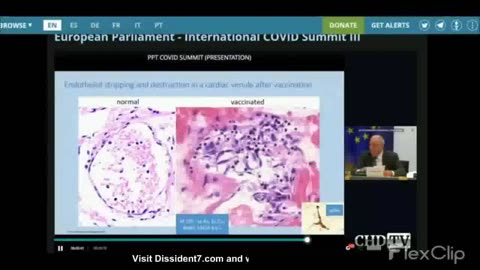 European International Parliament "Covid Summit" Looks at Spike Proteins in Vaccinated Peoples Organ