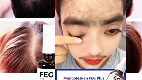 "Say Goodbye to Hair Woes with FEG - The Ultimate Solution!"