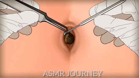 navel ASMR animation TREATMENT