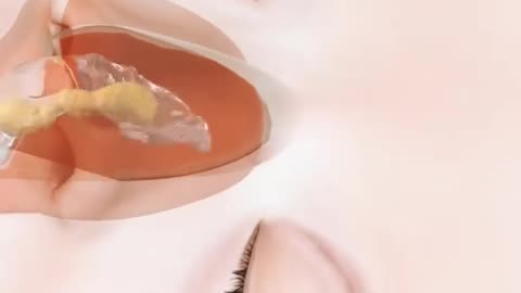 Sinus Rinse Procedure 3D Animation