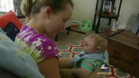 'Miracle Baby' Born Without Most of His Brain Defying Odds | ABC News