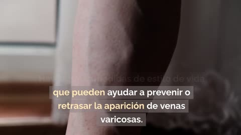 Evita el dolor: Descubre cómo tratar las venas varicosas