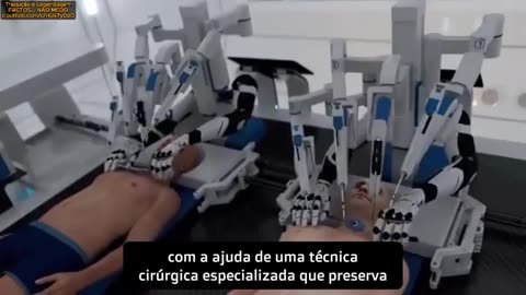 🎬🔥BRAINBRIDGE: O PRIMEIRO SISTEMA DE TRANSPLANTE DE CABEÇA🔥🎬