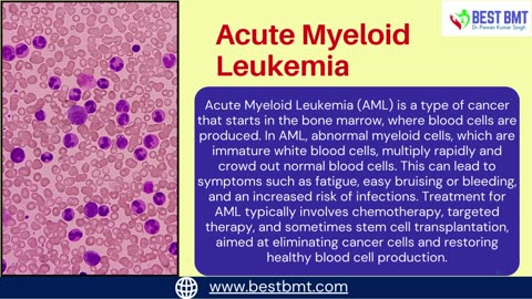 Understanding of Acute Myeloid Leukemia