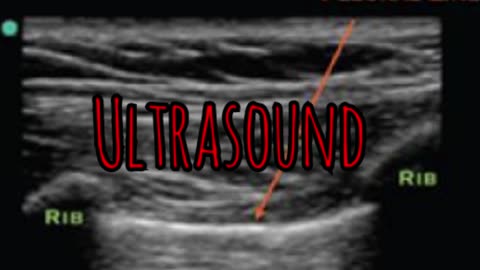 Prolonged Field Care Podcast 118: Ultrasound