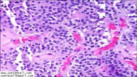 Endocrinology - Section 2 - MedQuest