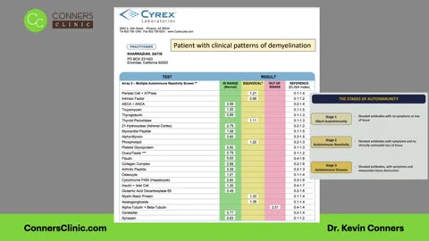 Stages of Autoimmune Disease | Conners Clinic