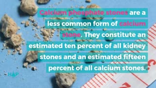 Guide To The Types Of Kidney Stones