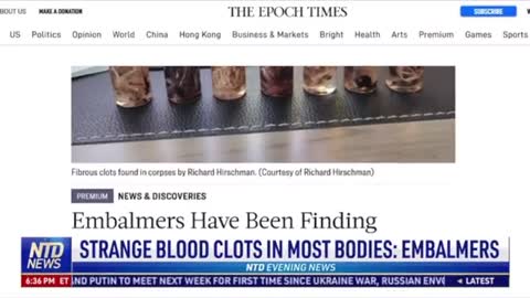 BLOOD CLOTS? NO THEY ARE SOMETHING ELSE.