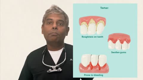 Top 3 problems with Missing Teeth and Solution to restore them!!