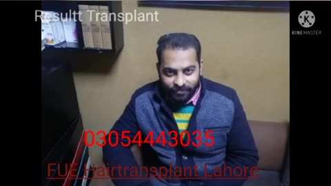 Fue hair transplant