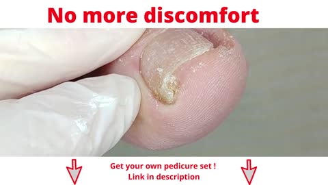 No more discomfort - skillful pedicure!!